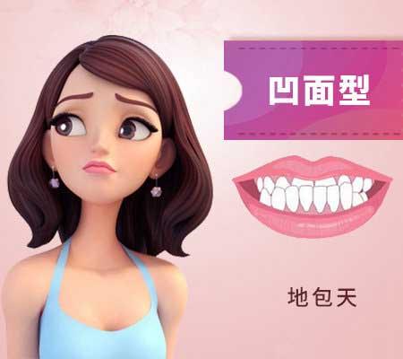什么是地包天？地包天長(zhǎng)什么樣子？地包天牙齒圖片