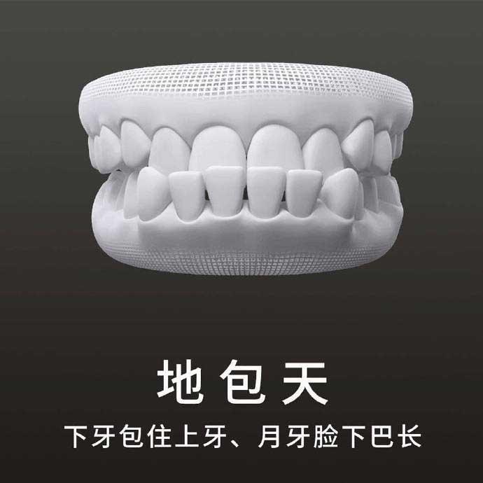 什么是地包天？地包天長(zhǎng)什么樣子？地包天牙齒圖片
